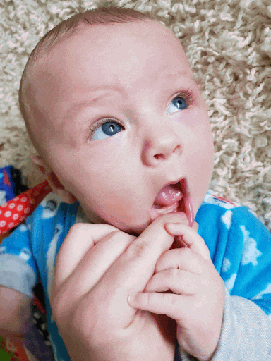 gif of some of the 1600 pictures of baby boy's mouth through the teething process