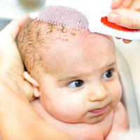 best cradle cap shampoo